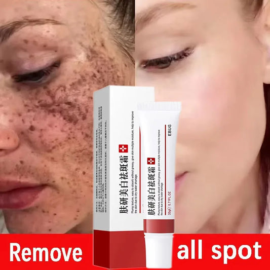 Effective Spot Removing Face Cream Whitening Freckle Remove Melasma Fade Melanin Anti-Pigmentation Improve Dullness Skin Care