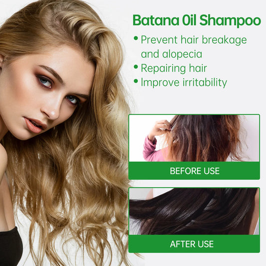 Batanana Hair Strengthening Shampoo 300ml - Batanana Oil & Rosemary Formula, Nourishes Scalp & Reduces Split Ends.