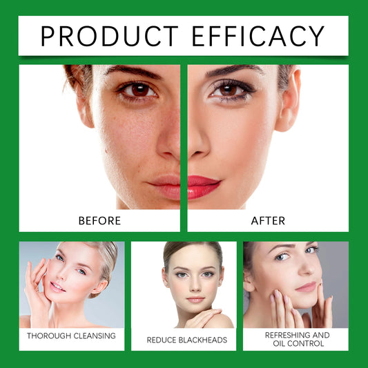 Aloe Cleansing Foam Gently Cleanses The Face Deeply Hydrates Pores Controls Oil Moisturizes And Is Comfortable Without Tightness