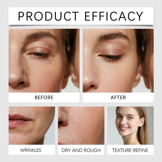 Volufilin 100% Facial Ampoule Serum,Pure Volufiline Plumping,Improve Depressions&Facial Reshaping,Hydrolyzed Collagen Elastic Lifting&Deep Hydrating Glow Moisture,Versatile Multi Zone Application&Concentrated Ampoule Formula,