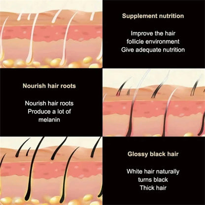 Gray White Hair Treatment Serum Cover White Hairs To Black Natural Color Repair Spray Anti Loss Hair Restore Healthy Hair Care