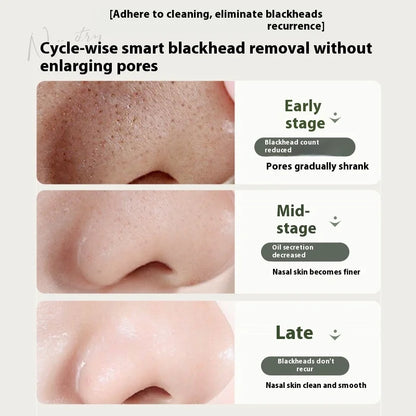 RUYI Purifying & Moisturizing Blackhead Nose Mask, Gentle Deep Clean, Non-Drying Pore Cleanser Blackhead Remover Nasal Mask 100g