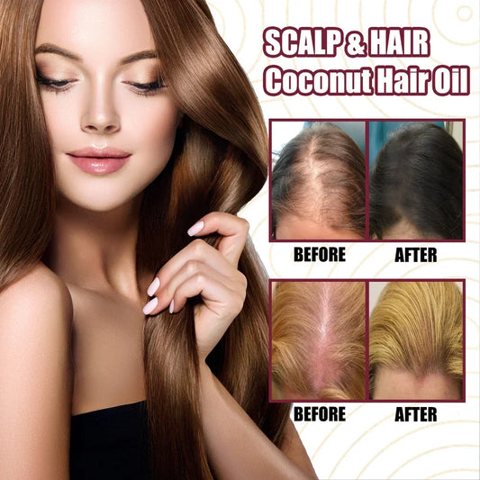 30ml Onion Black Seed Hair Oil Spray for Natural Hair Care and Growth Prevent Hair Loss Biotin Fast  Growth