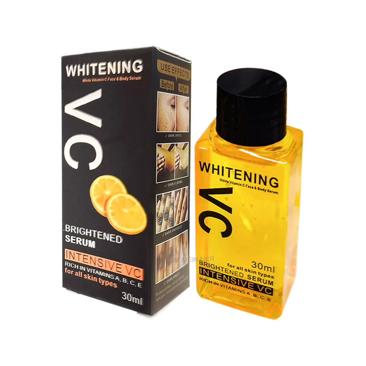 Whitening Body Serum Bleaching Brightening Skin,AHA,Vitamin B,C 30 Ml Bleaching Dark Spot Serum