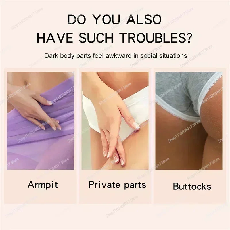 HOT~Whitening Cream Private Parts Underarm Bleaching Serum Whiten Butt Knee Brighten Inner Thigh Intimate Parts Dark Remove Mela