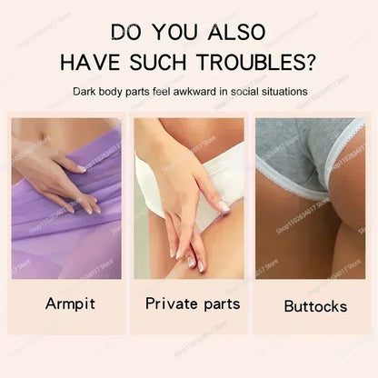 HOT~Whitening Cream Private Parts Underarm Bleaching Serum Whiten Butt Knee Brighten Inner Thigh Intimate Parts Dark Remove Mela