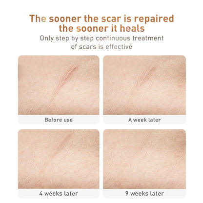 LANBENA Skin Care Gel Face Cream Acne Scar Removal Cream Stretch Marks Whitening Facial Moisturizer Skin Care