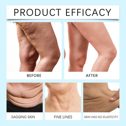 Retinol Body Butter Cream Anti Wrinkle Firming Moisturizer for Sagging Skin Deep Hydration Stretch Marks Vitamin B5 All Skin 60g