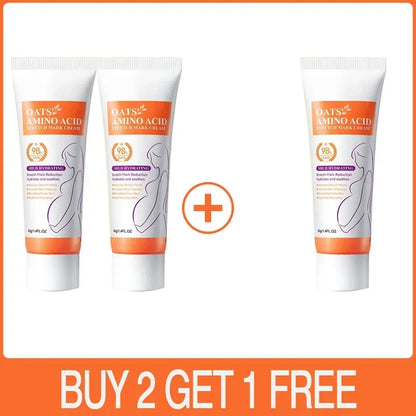 Stretch Marks Removal Cream Light Lines Postpartum Obesity Pregnancy Powerful Fast Absorption