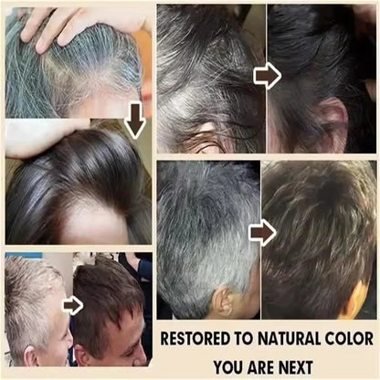 Gray White Hair Treatment Serum Cover White Hairs To Black Natural Color Repair Spray Anti Loss Hair Restore Healthy Hair Care