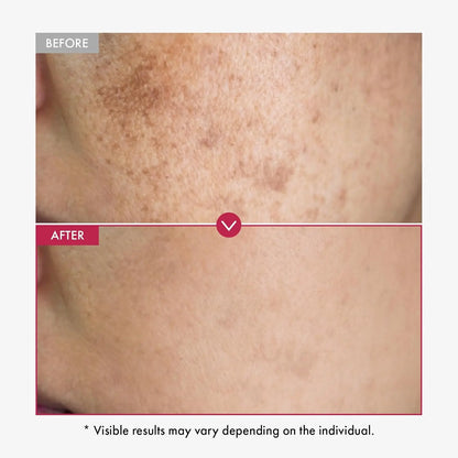 Alpha Arbutin Serum AHA Keeps Face And Body Serum Smooth Brightening Moisturizing Improving Dullness Dark Skin Beauty Care Cream