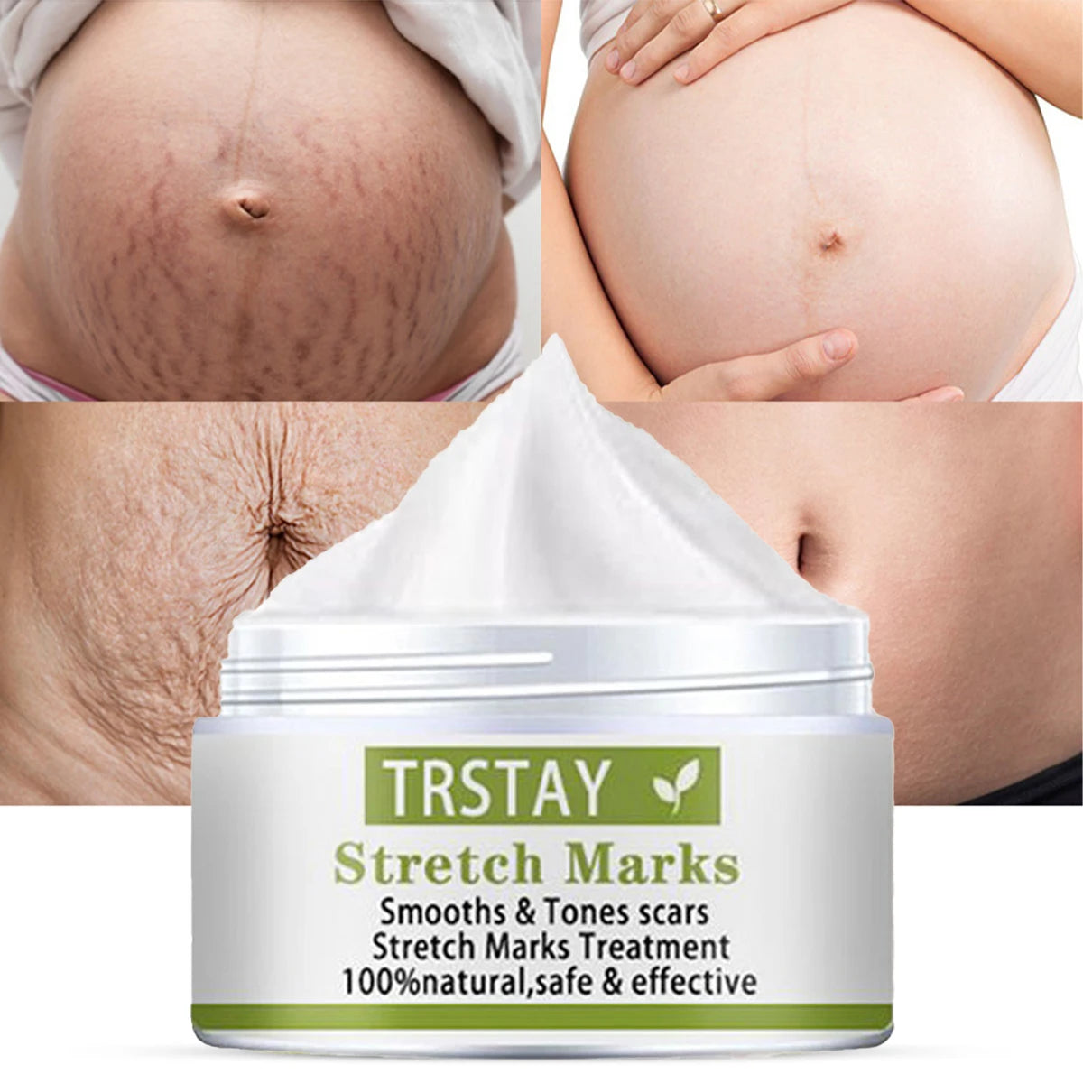 TRSTAY Stretch Mark Scar Repair Cream Enhances Skin Elasticity Moisture Collagen Improvement Safe And Effective