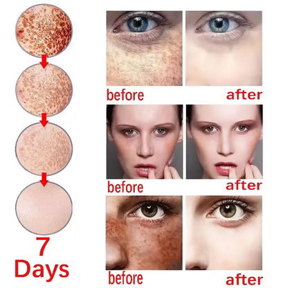 Effective Spot Removing Face Cream Whitening Freckle Remove Melasma Fade Melanin Anti-Pigmentation Improve Dullness Skin Care