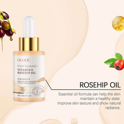 Moisturizing Squalane Rosehip Face Oil Lifting Firming Fade Fine Lines Smoothing Nourishing Skin Rejuvenation Facial Care Oil