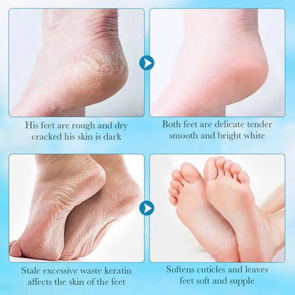 SADOER 1/2Pairs Moisturizing Exfoliating Aloe Vera Foot Peel Mask Sock Pedicure Peeling Dead Skin Remover Feet Mask SkinCare