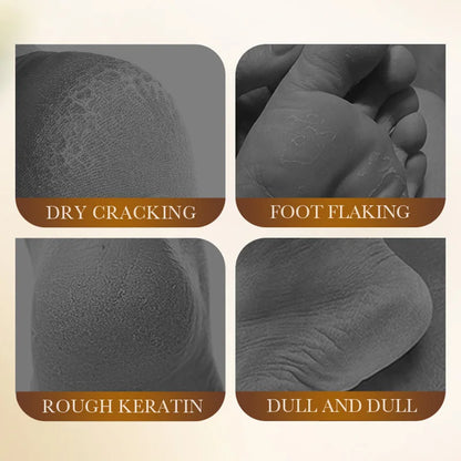 5 Pairs BIOAQUA White Rice Foot Mask Moisturizing Foot Peeling Mask Exfoliating Feet Spa Pedicure Exfoliant Feet Skin Care