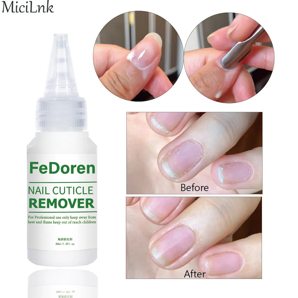 30ML Nail Cuticle Remover Softener Liquid Nail Repair Gel Exfoliator Cuticle Treatment Manicure Soften Dead Skin For Nails Care