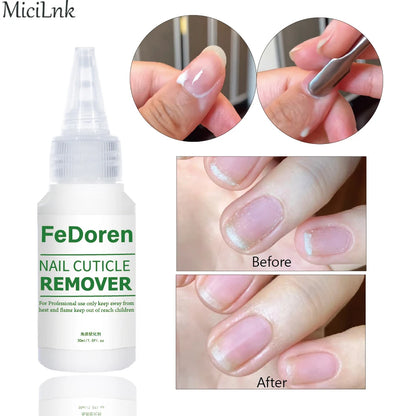30ML Nail Cuticle Remover Softener Liquid Nail Repair Gel Exfoliator Cuticle Treatment Manicure Soften Dead Skin For Nails Care