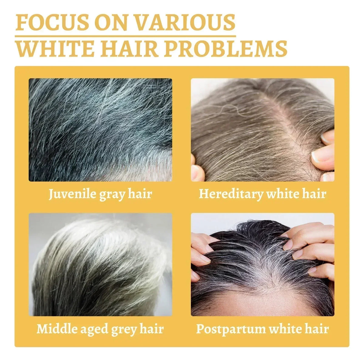 Gray White Hair Treatment Serum Liquid White To Black Natural Color Repair Nourish Product Anti Loss Hair Care Men Women
