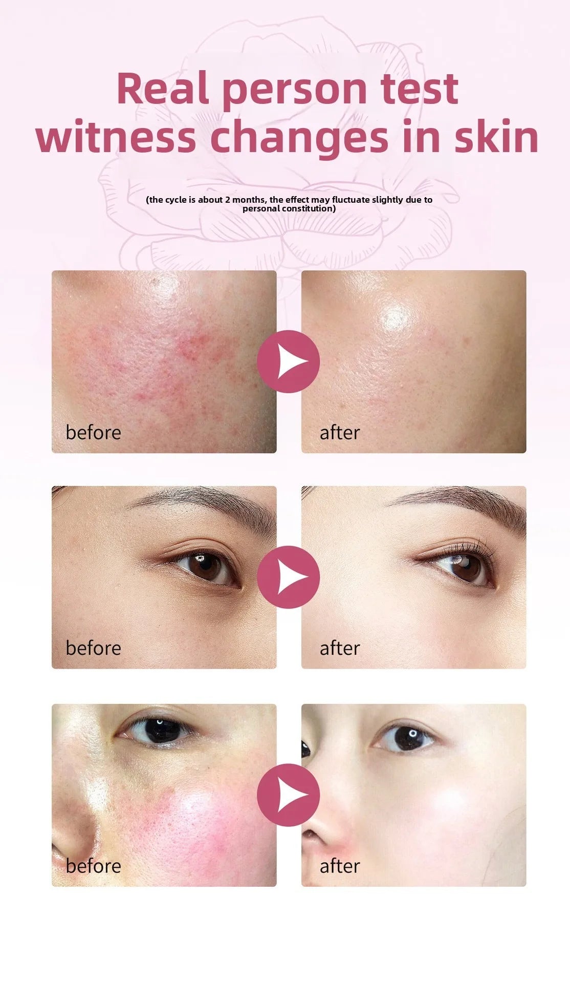 Rose Proxylane Serum Anti-Aging Moisturizing Shrink Pores Hydrating Whitening Essence For Microneedle Instruments Skin Care