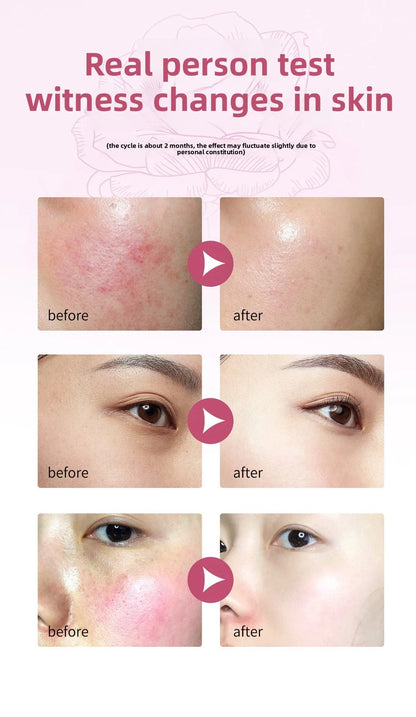 Rose Proxylane Serum Anti-Aging Moisturizing Shrink Pores Hydrating Whitening Essence For Microneedle Instruments Skin Care