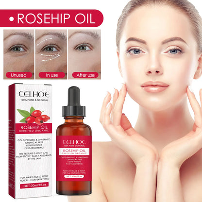 EELHOE Rosehip Facial Essential Oil Fade Fine Line Lifting Firming Repair Smooth Moisturizing Whitening Nourishing Skincare Oil