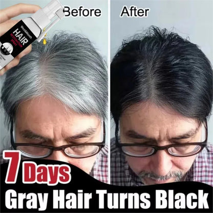 Gray White Hair Treatment Serum Cover White Hairs To Black Natural Color Repair Spray Anti Loss Hair Restore Healthy Hair Care
