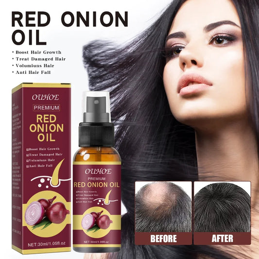 30ml Onion Black Seed Hair Oil Spray for Natural Hair Care and Growth Prevent Hair Loss Biotin Fast  Growth