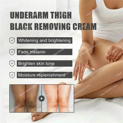 HOT~Whitening Cream Private Parts Underarm Bleaching Serum Whiten Butt Knee Brighten Inner Thigh Intimate Parts Dark Remove Mela