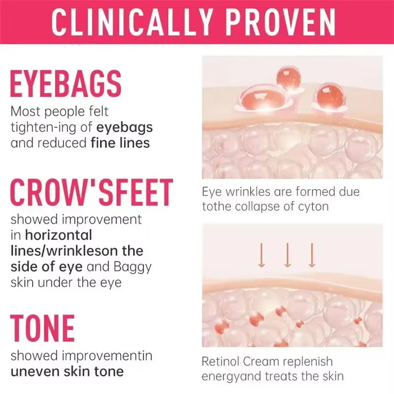 Instant Eye Bag Remove Cream Retinol Anti-Wrinkle Firming Skin Fade Fine Lines Anti Dark Circle Puffiness Brighten Eye SkinCare