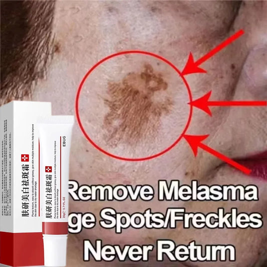 Effective Spot Removing Face Cream Whitening Freckle Remove Melasma Fade Melanin Anti-Pigmentation Improve Dullness Skin Care