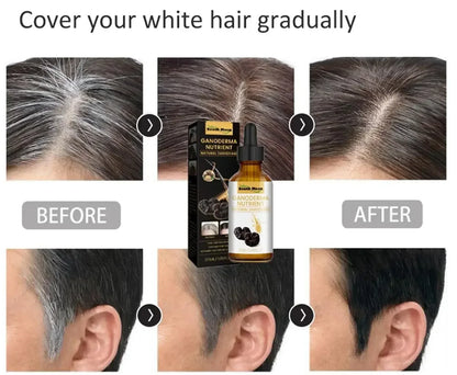 Gray White Hair Treatment Serum Liquid White To Black Natural Color Repair Nourish Product Anti Loss Hair Care Men Women