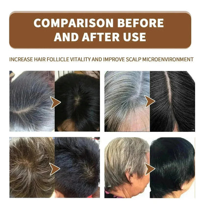 Gray White Hair Treatment Serum Cover White Hairs To Black Natural Color Repair Spray Anti Loss Hair Restore Healthy Hair Care