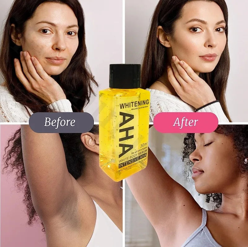 Whitening Body Serum Bleaching Brightening Skin,AHA,Vitamin B,C 30 Ml Bleaching Dark Spot Serum