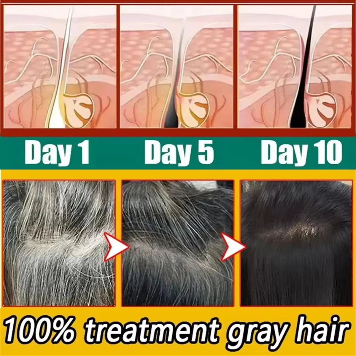 Gray White Hair Treatment Serum Cover White Hair To Black Natural Color Repair Spray Anti Loss Hair Restore Healthy Hairs Care