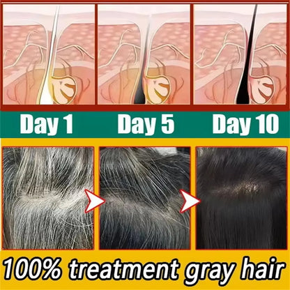 Gray White Hair Treatment Serum Cover White Hair To Black Natural Color Repair Spray Anti Loss Hair Restore Healthy Hairs Care