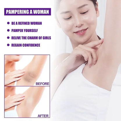 Skin Whitening Cream Private Tender White Lips Joint Melanin Removal Maintenance Armpit Private Parts Underarm Bleaching Serum
