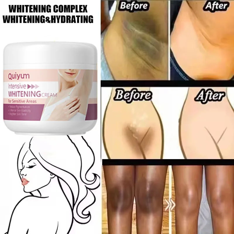 Whitening Cream For Dark Skin Underarm Bleaching Armpit Lightening And Intimate Area Woman Moisturizer Korean Skin Care Products