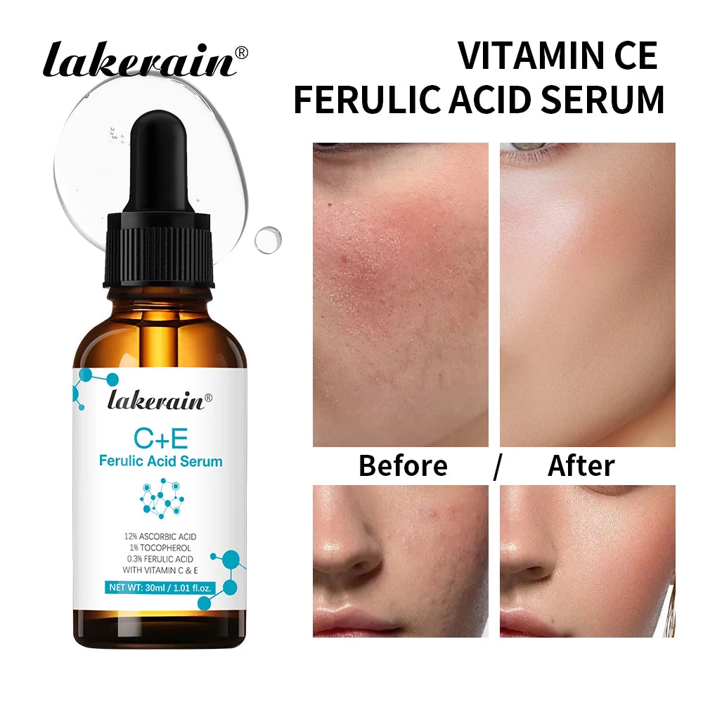 Vitamin C Face Serum Reduce Dark Spots Acne Scars Provides Firming Diminishes Fine Lines Facial Essence Korean Skin Care Product