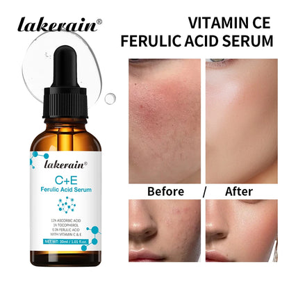 Vitamin C Face Serum Reduce Dark Spots Acne Scars Provides Firming Diminishes Fine Lines Facial Essence Korean Skin Care Product