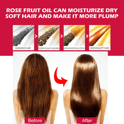 EELHOE Rosehip Facial Essential Oil Fade Fine Line Lifting Firming Repair Smooth Moisturizing Whitening Nourishing Skincare Oil
