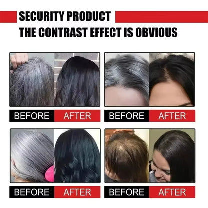 Gray White Hair Treatment Serum Cover White Hair To Black Natural Color Repair Spray Anti Loss Hair Restore Healthy Hairs Care