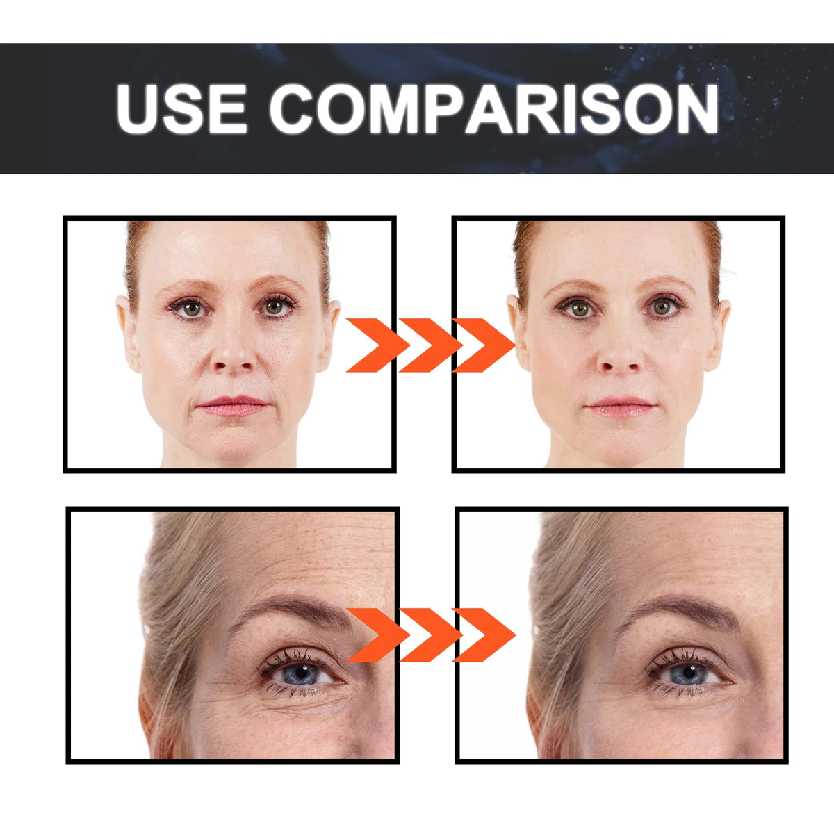 Retinol 0.5% Squalane Essence Wrinkle Remover Fade Fine Lines Anti-aging Moisturizing Whitening Firming Repair Skincare Serum