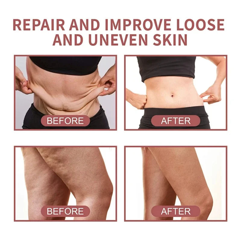 Peach Firming Body Cream Anti-Cellulite Skin Smoothing Tightening Lotion for Women Reduce Stretch Marks Improves Skin Elasticity