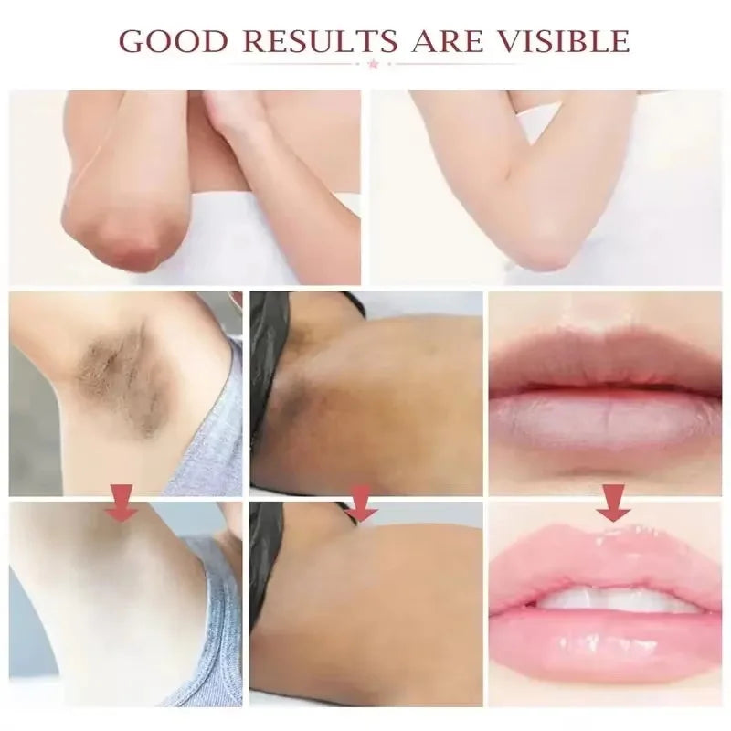 Whitening Cream For Dark Skin Underarm Bleaching Armpit Lightening And Intimate Area Woman Moisturizer Korean Skin Care Products