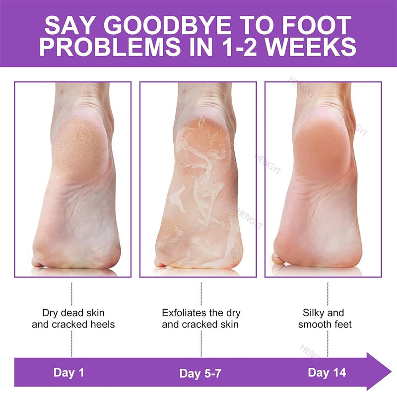 Foot Peel Mask 10 Pack Exfoliator Lavender Natural Peel Off Calluses Dead Skin Callus Remover Moisturizing Smooth For Men Women