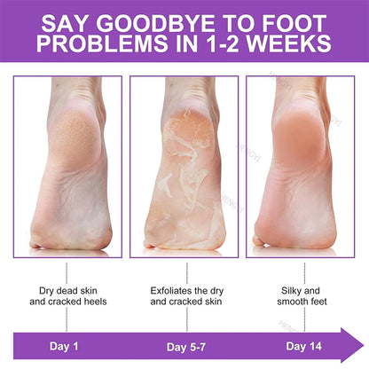 Foot Peel Mask 10 Pack Exfoliator Lavender Natural Peel Off Calluses Dead Skin Callus Remover Moisturizing Smooth For Men Women