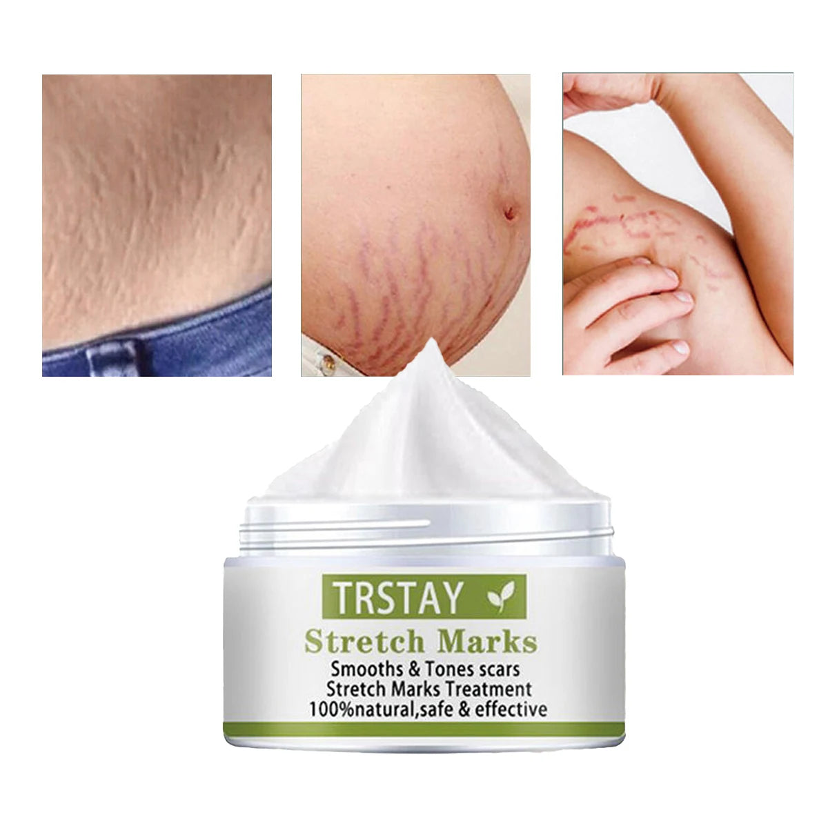 TRSTAY Stretch Mark Scar Repair Cream Enhances Skin Elasticity Moisture Collagen Improvement Safe And Effective