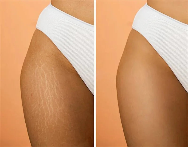 Peach Firming Body Cream Anti-Cellulite Skin Smoothing Tightening Lotion for Women Reduce Stretch Marks Improves Skin Elasticity
