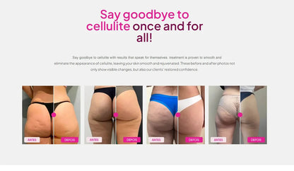 Hot Firming Cream for Belly Thighs Cellulite Treatment Tightening Moisturizing Warming Body Lotion for Dry Skin